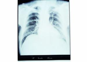 Quality Konida Dry Imaging Film , Medical Paper Laser Imaging Film wholesale