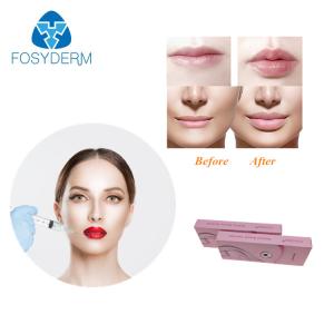 Quality Fosyderm Hyafilia 2ml Lip Filler Hyaluronic Acid Gel Injection wholesale