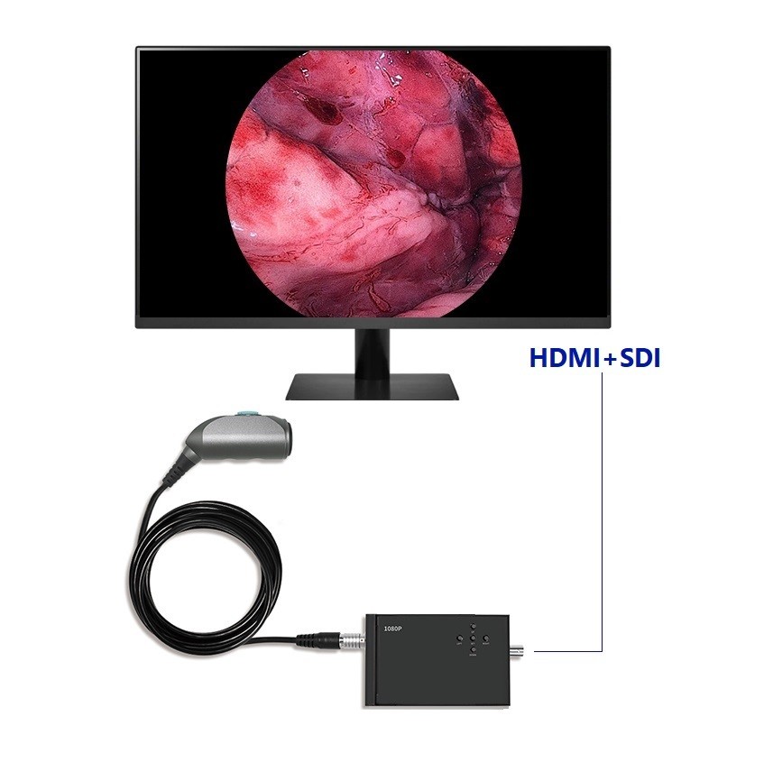 Black Portable Video Endoscope FHD Animals Medical Laparoscopy ENT Surgical Endoscope Camera