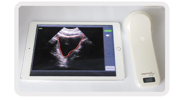 Portable 4D Wireless Bladder Scanner WIFI Ultrasound Probe for Evaluation of Residual Quality After Urination