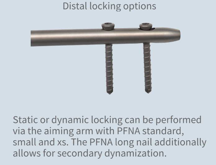 Orthopedic Trauma PFNA Femoral Intramedullary Interlocking Nail