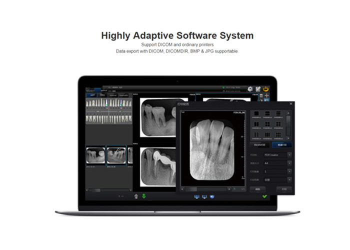 Dental oral Imaging Plate digital X-ray Radiography Imaging System Film Scanner