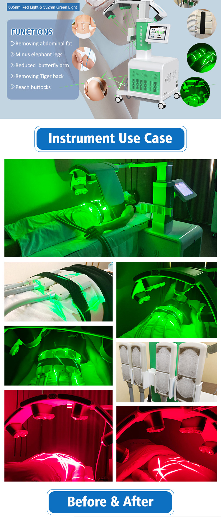 XM-227 Weight Loss Green Laser 10D Maxlipo Master Laser And EMS Cryo plate Beauty Machine