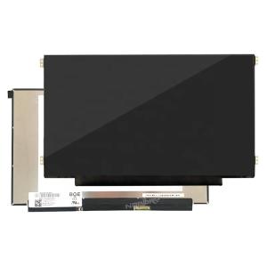 Quality 15.6 Inch OLED Display Module 300 cd/㎡ wholesale