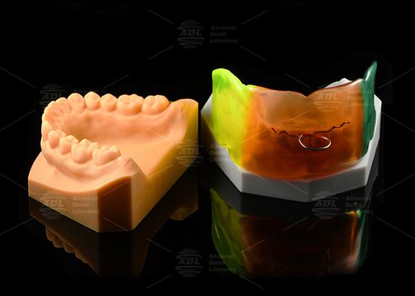 Adjustable Medical Silicone Vestibular Shield Breathable Orthodontic Functional