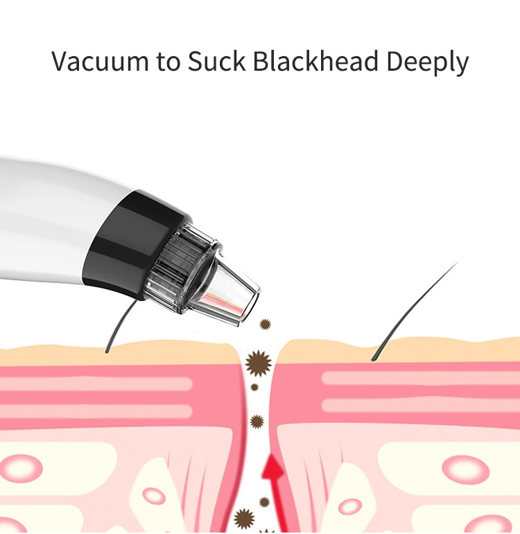 3 Hours Charge ABS USB Vacuum Blackhead Remover