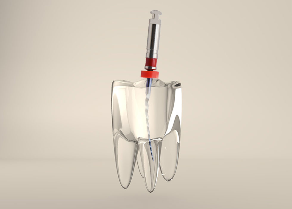 4% And 6% Niti Kid Files 17/19mm For Children Root Canal Endodontic Treatment