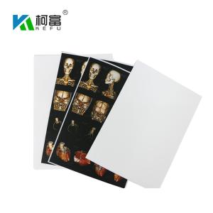 Quality Blue White Base Medical X Ray Film 35x43CM 10x12 Inch X Ray Dry Film For Fuji Printer wholesale