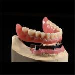 CAM Milled Titanium Bar Dental Implant Hybrid Prosthesis Dentures