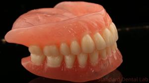 Quality Heat Cured Ivoclar Full Acrylic Denture Dental Lab High Accuracy High Esthetic Advantage wholesale