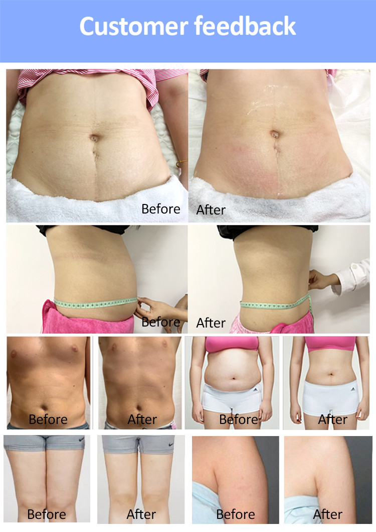 Pain Free Non Invasive Body Sculpting Device 635nm Laser Beauty Equipment