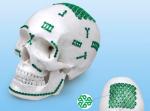 2.0mm HA Maxillofacial Implant YM Type Orthopedic Bone Plates