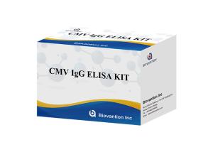Quality For Laboratory Or Hospital High Accuracy IgG Antibodies To Cytomegalovirus Elisa Test Kit wholesale