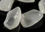 Natural Pressed EMAX Veneer Strength 16 Shades Emax Teeth Veneers