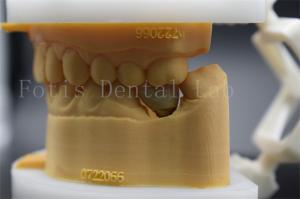 Quality Long Lasting Polished Dental Lab Crowns Precision Fit Comfort For Patients wholesale