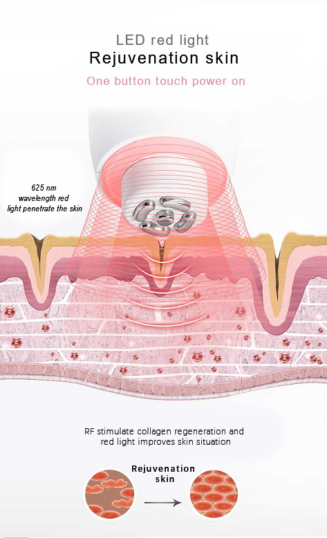 3.5H Removal Acne 10W Radio Frequency Beauty Instrument
