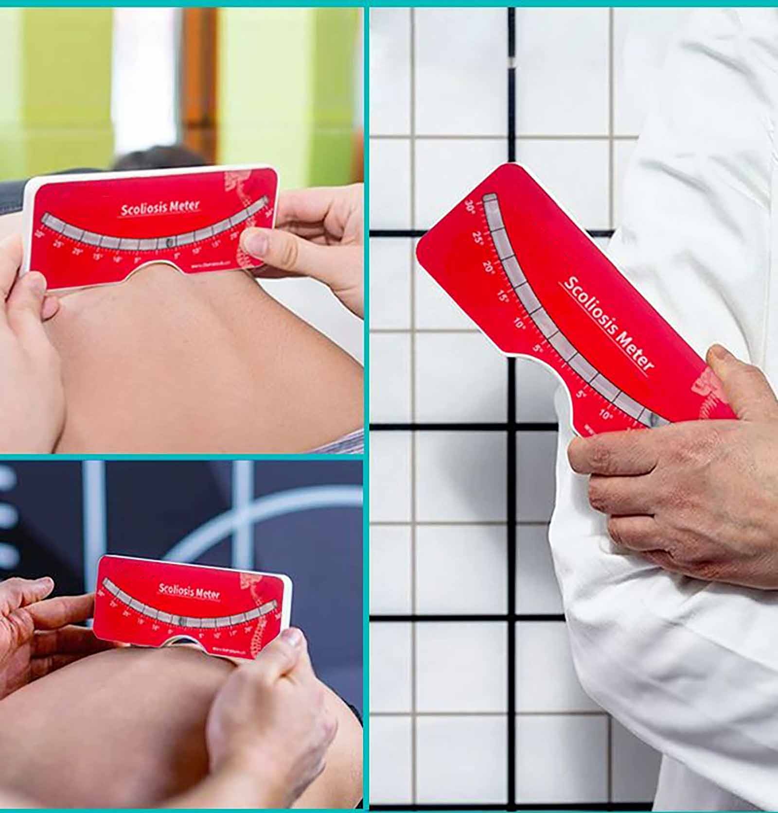 Custom Precise Scoliosis Scoliometer Measurement With Spine Contour