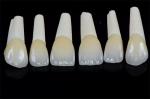 Long Lasting Permanent White Dental Porcelain Veneers Stain Resistance