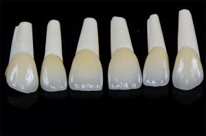 Quality Long Lasting Permanent White Dental Porcelain Veneers Stain Resistance wholesale
