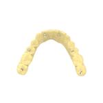 Dental Bridge Photosensitive Resin Non Toxic Temporary Resin Crown