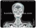 High Density Medical X Ray Film Blue For Konida Laser Printer