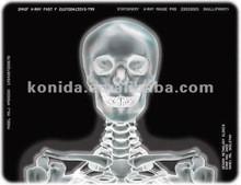 Quality Medical X Ray Thermal Printer Film KND-F25*30cm wholesale