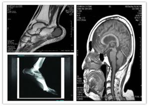 Quality Medical Digital Blue Base Dry Imaging Film 8 x 10in Compatible Hosipital Mri Scan wholesale