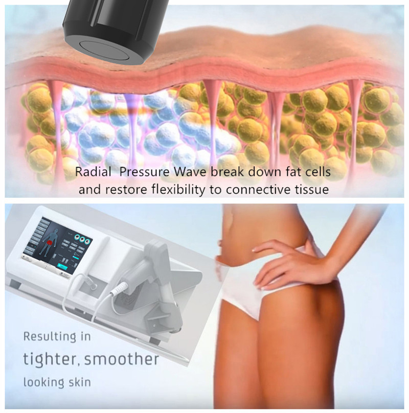 Extracorporeal Air Pressure Therapy Machine Acoustic Wave Type For Sports Injury Recovery