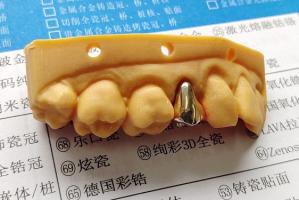 Quality High Noble Gold Full Metal Dental Crown wholesale