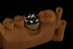 Professional Grade Dental Zirconia Hybrid Imitation Material Smooth Or Rough