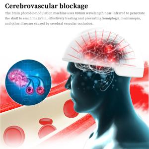 Quality White Color Health Analyzer Machine Photobiomodulation Brain Injury Therapy wholesale