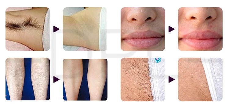 AS31Wholesale Diode Laser Beauty Machine 600W 2 in 1 IPL machine OPT Laser Painless Hair Removal device for salon beauty