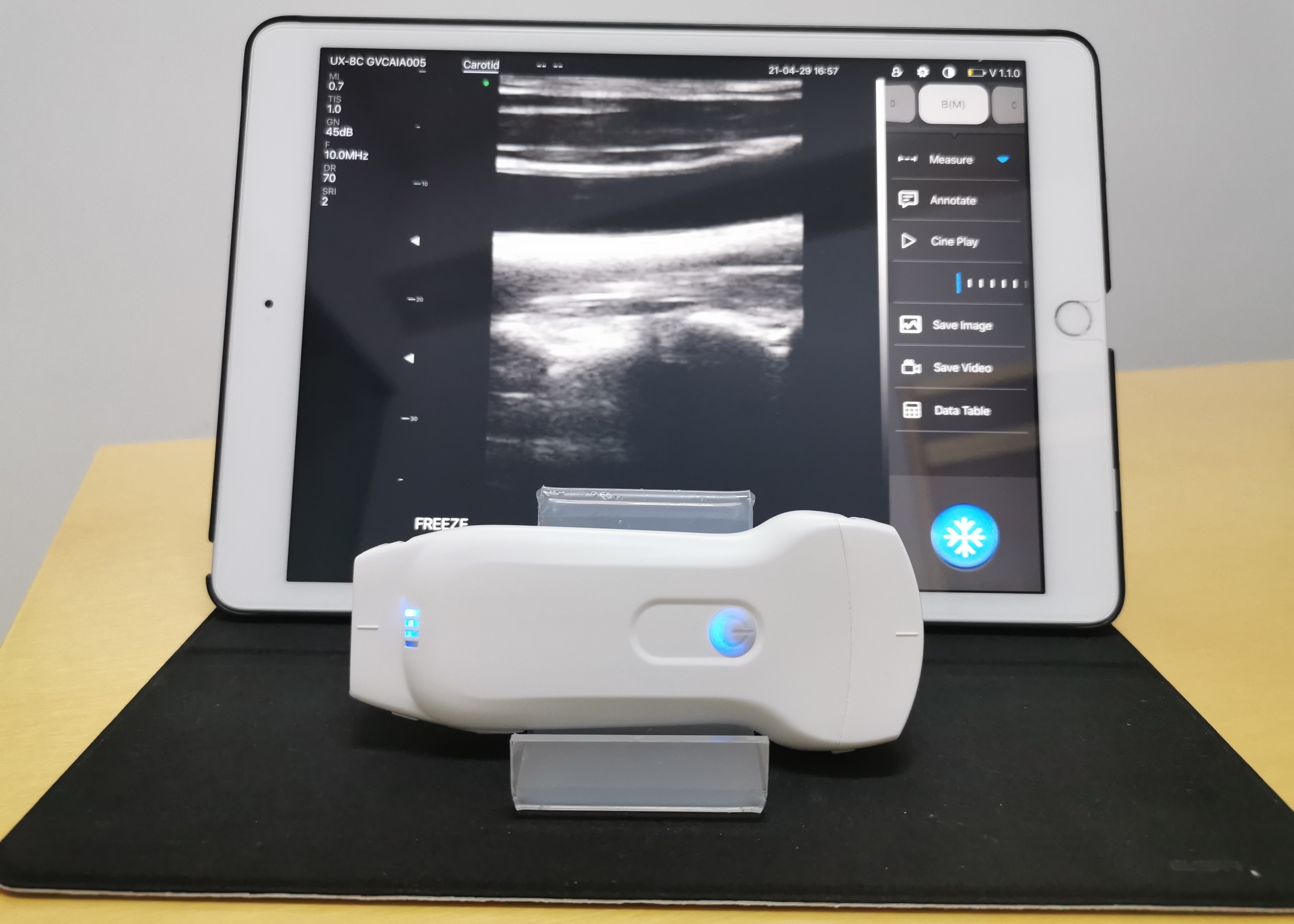 Highest Cost-effective Double Probes Wireless Color Doppler Ultrasound Scanner