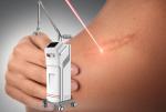 3 Probes CO2 Fractional Laser Machine Medical Beauty Equipment Vaginal
