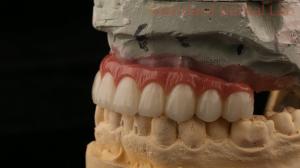 Quality Hybrid Titanium Screw Retained Dental Implant Crown All On 4 Dental Implant Zirconia Bridge wholesale