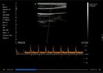 Pocket Wireless Ultrasound Probe Handheld Ultrasound Probe Mini Ultrasound Only