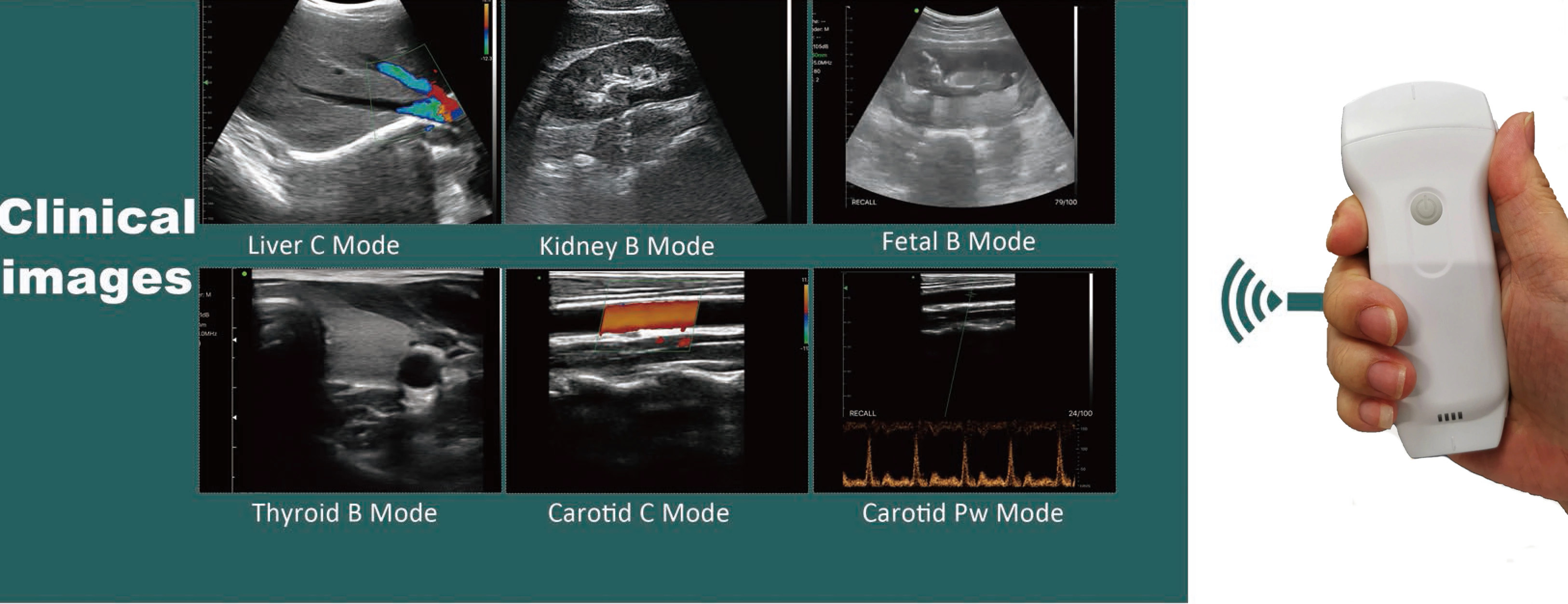 GH G10RL USB Portable Color Doppler Ultrasound Transducer Machine