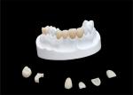 Inlays Onlays Ceramic Dental Crown Strong Veneer For Dental Department