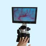 Nailfold Microcirculation Microscope for Nutritionist , nail microscope