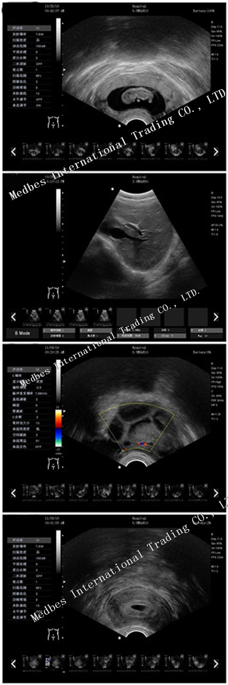 Portable Ecografo 4D Color Doppler Ultrasound Machine, Portable Echo Ultrasound Scanner