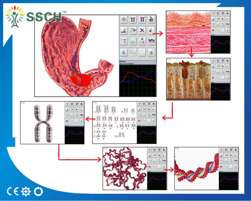 Customise Service Machinery Health Analyzer For Body Health Diagnose