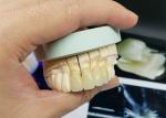 Safety Corrosion Resistant OEM Porcelain Crown All Ceramic Natural Look