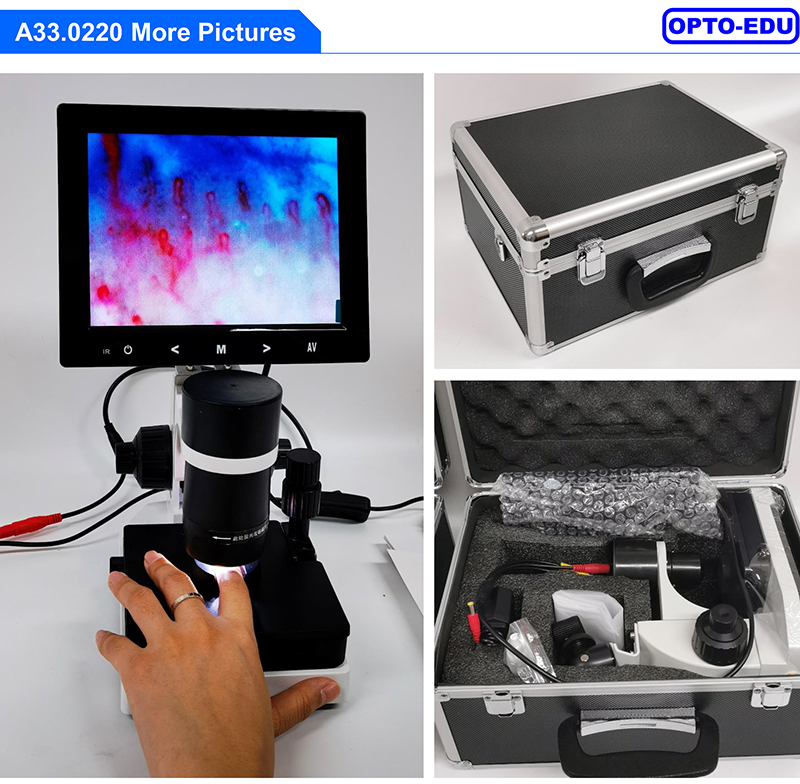 OPTO EDU A33.0220 Microcirculation Microscope 480x Nail Checking With 8" LCD Screen