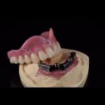 CAM Milled Titanium Bar Dental Implant Hybrid Prosthesis Dentures