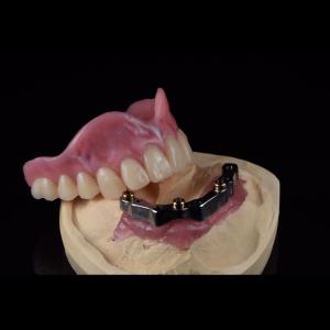 Quality CAM Milled Titanium Bar Dental Implant Hybrid Prosthesis Dentures wholesale