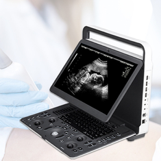 Sonoscape E2 Ecografo Cardiac Vascular Diagnosis B/ 2B/ 4B/ M/ Color Doppler Ultrasound Machine Requipo De Ultrasonido