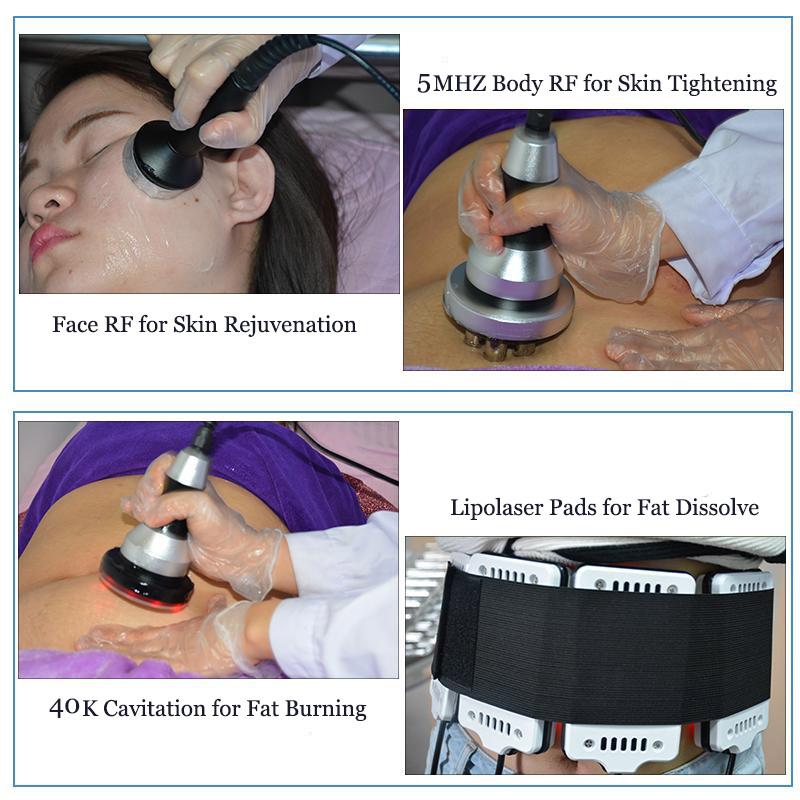 Cryo+Laser+40k Cavitation for Body Face 360 Surrounding Cooling Technology Slimming Machine for Beauty Clinic Salon