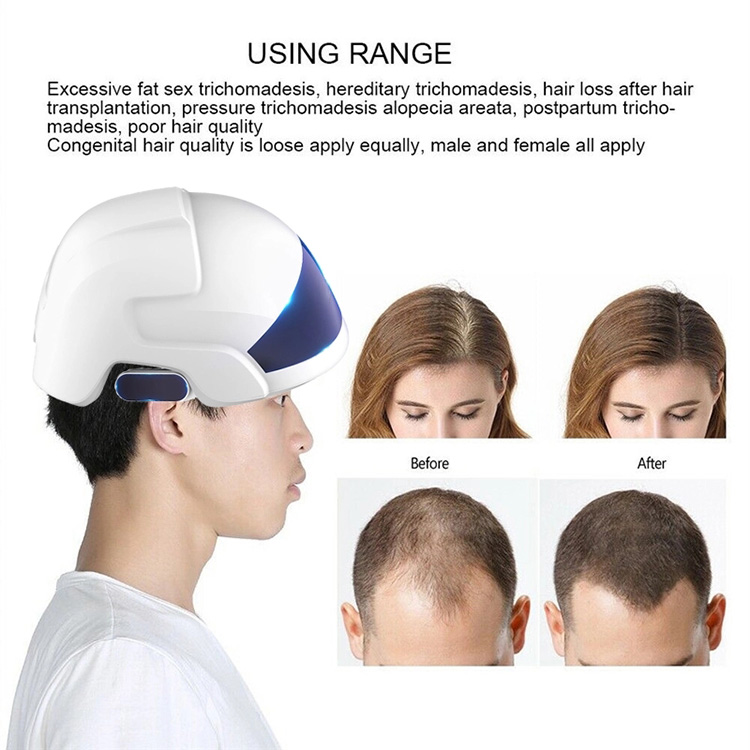 650nm Led Light 30 Diode 26 Lasers Hair Growth Helmet Laser Therapy For Hair Loss