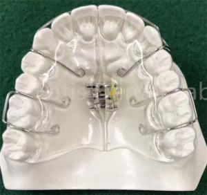 Quality State-Of-The-Art Orthodontics Appliance Expanding Retainer Customizable wholesale
