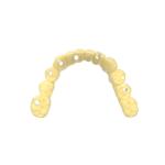 Transparent Biocompatible Resin Temporary Restorations Dental Resin 3d